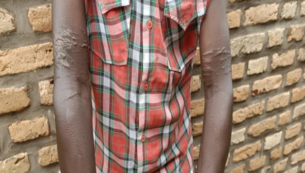 Persécutions de réfugiés rapatriés au Burundi : le témoignage d'un habitant de Kirundo